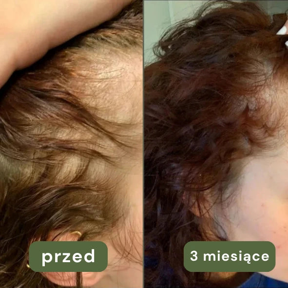 Olejek na porost włosów Novaherbs
